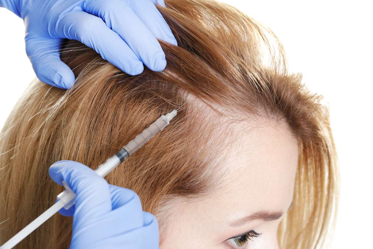 Thinking of a hair transplant? 6 factors to consider