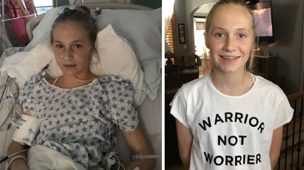 Idaho community rallies around teen who had open-heart surgery