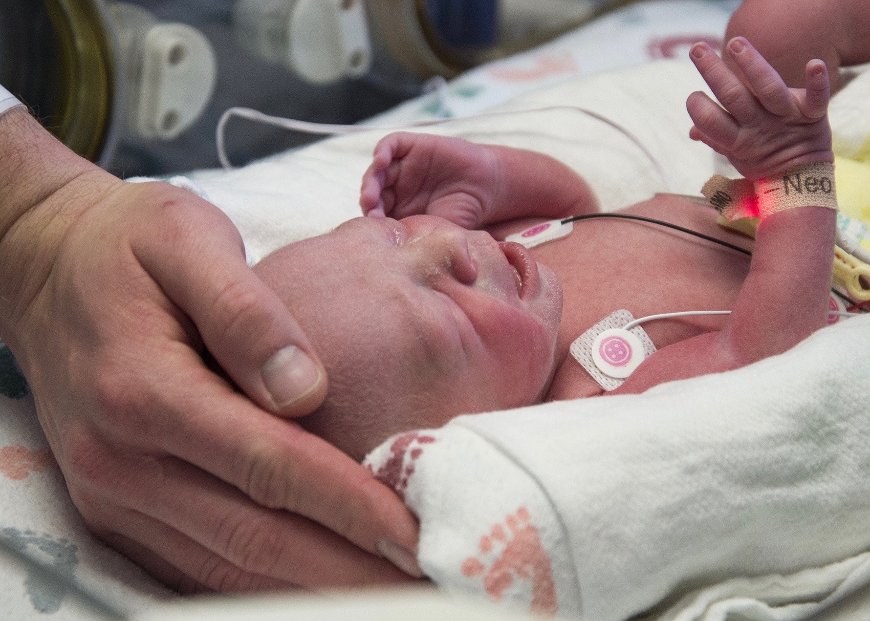 Doctors: Over a year to see if uterus transplant successful