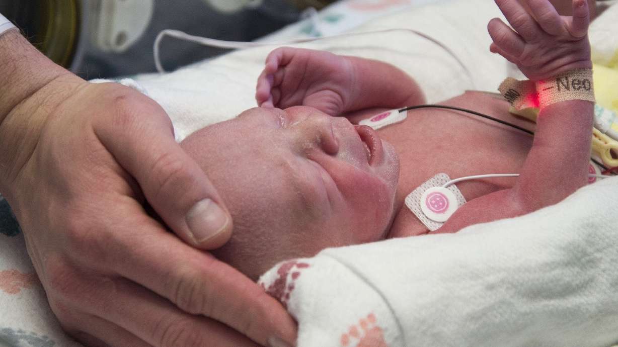 Doctors: Over a year to see if uterus transplant successful