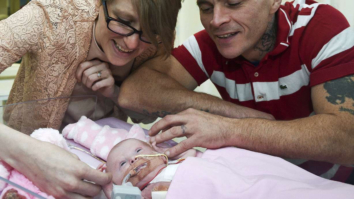 Baby's heart placed back inside her chest in rare surgeries