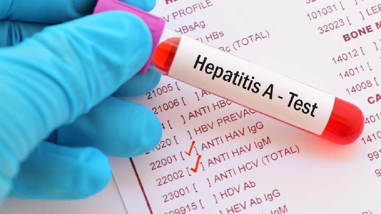 Hepatitis A outbreak: What it is, what to do about it