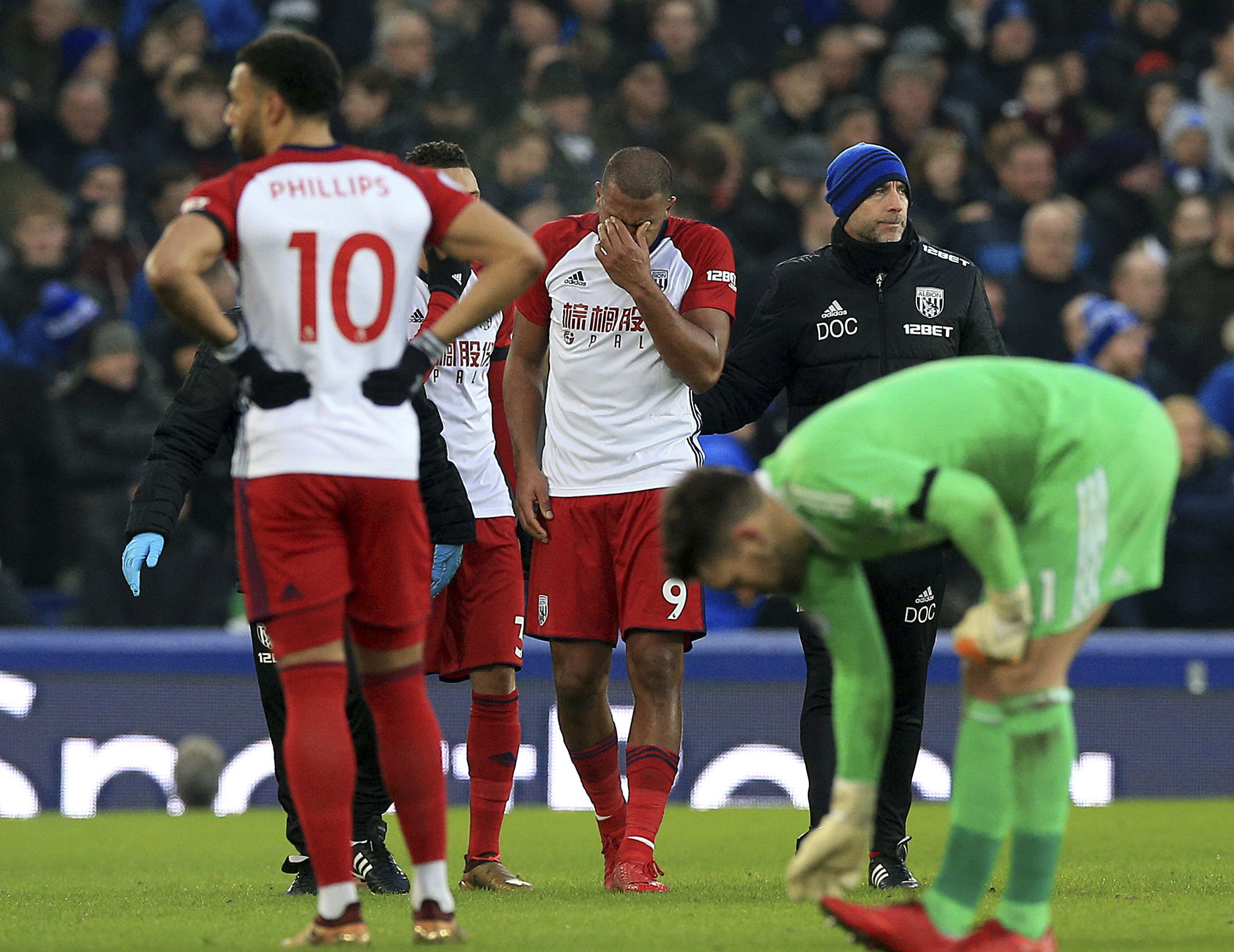 Double fracture for McCarthy in Everton draw with West Brom