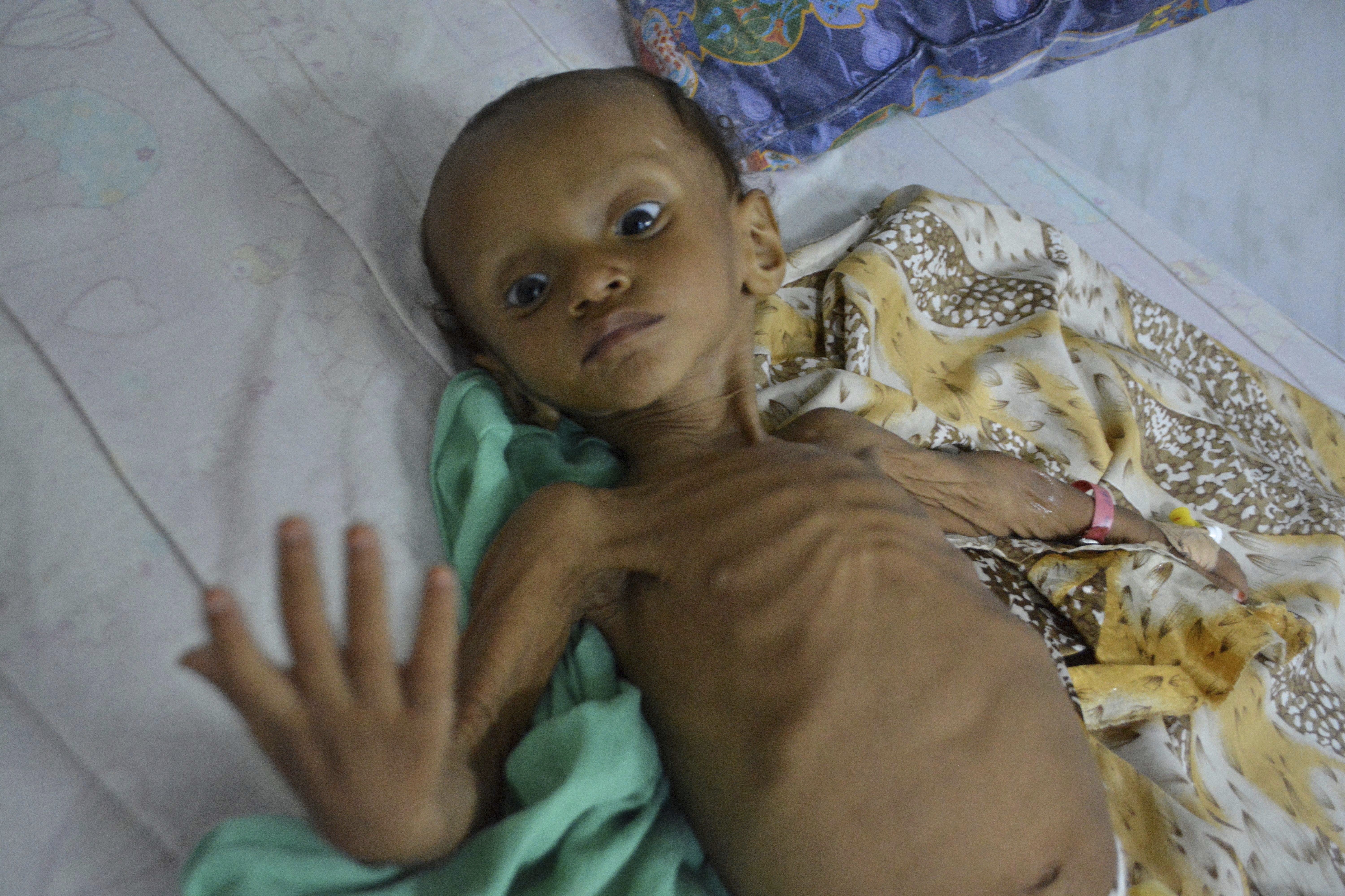 Yemen: The world's 'worst humanitarian crisis' in numbers