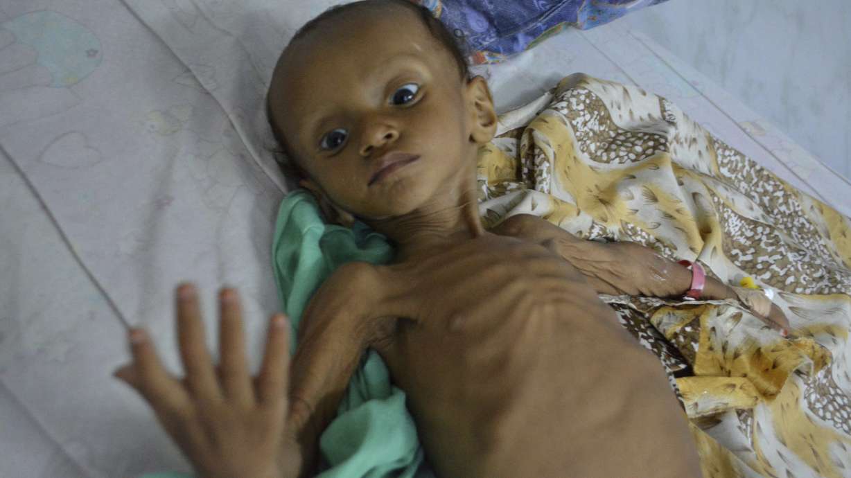 Yemen: The world's 'worst humanitarian crisis' in numbers