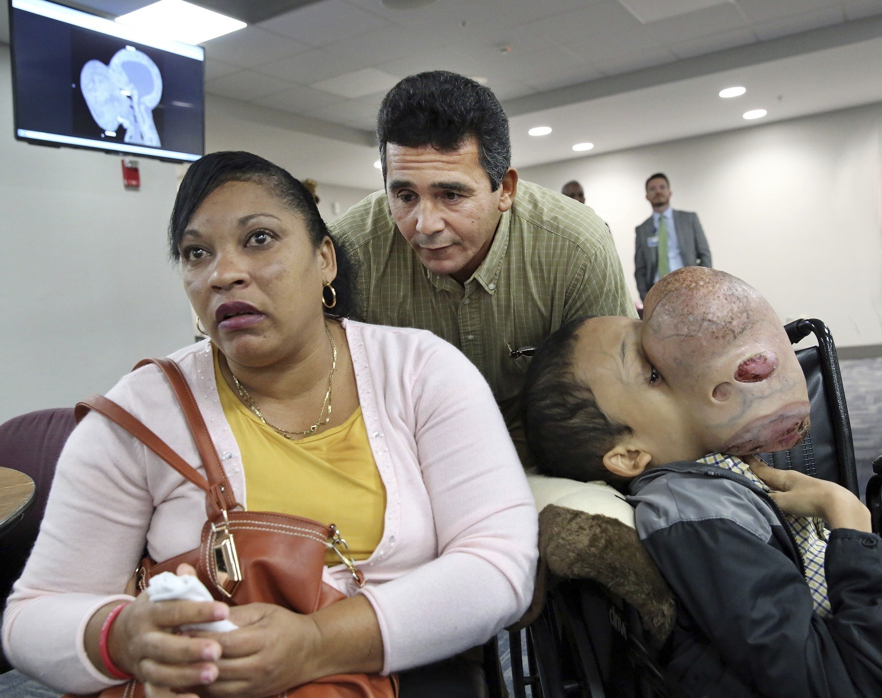 Cuban boy dies after surgery to remove 10-pound face tumor