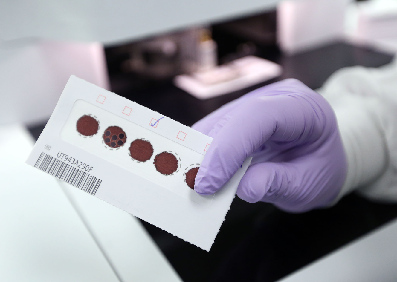 Microbiologist Erinn Hardin shows dried blood spots that she punches into sample wells for testing at the Utah Public Health Laboratory in Taylorsville on Wednesday, Jan. 31, 2018. Photo: Kristen Murphy, KSL