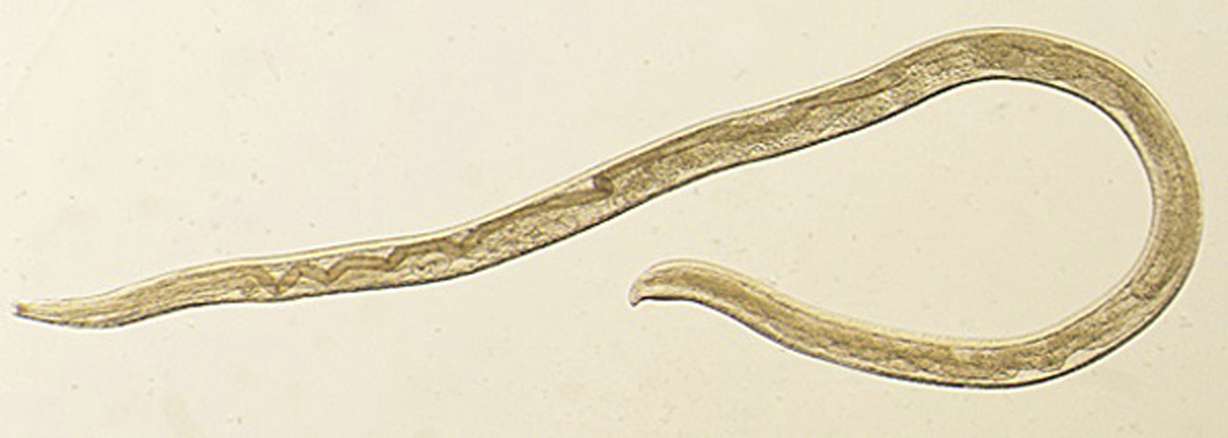 This undated photo provided by the Centers for Disease Control and Prevention (CDC) shows Thelazia gulosa, a type of eye worm seen in cattle in the northern United States and southern Canada, but never before in humans. An Oregon woman who had worms coming out of her eye is being called the first known human case of a parasitic infection spread by flies. Fourteen tiny worms were removed from the left eye of the 26-year-old woman in August 2016. Scientists reported the case Monday, Feb. 12, 2018. (CDC via AP)