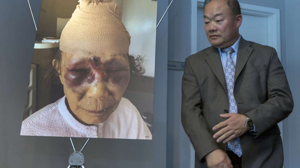 Homeless man arrested in random beating of elderly LA woman