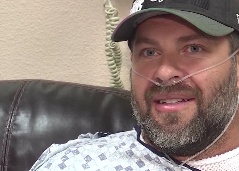 Utah man who survived lightning strike: ‘My memory just got erased’