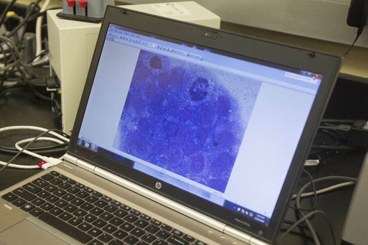 Leukemia stem cells are displayed on a computer in a lab at the Huntsman Cancer Institute in Salt Lake City on Monday, March 19, 2018. Photo: Jacob Wiegand, KSL