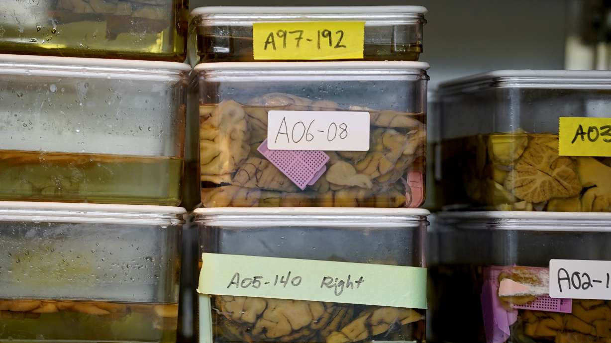 New way of defining Alzheimer's aims to find disease sooner