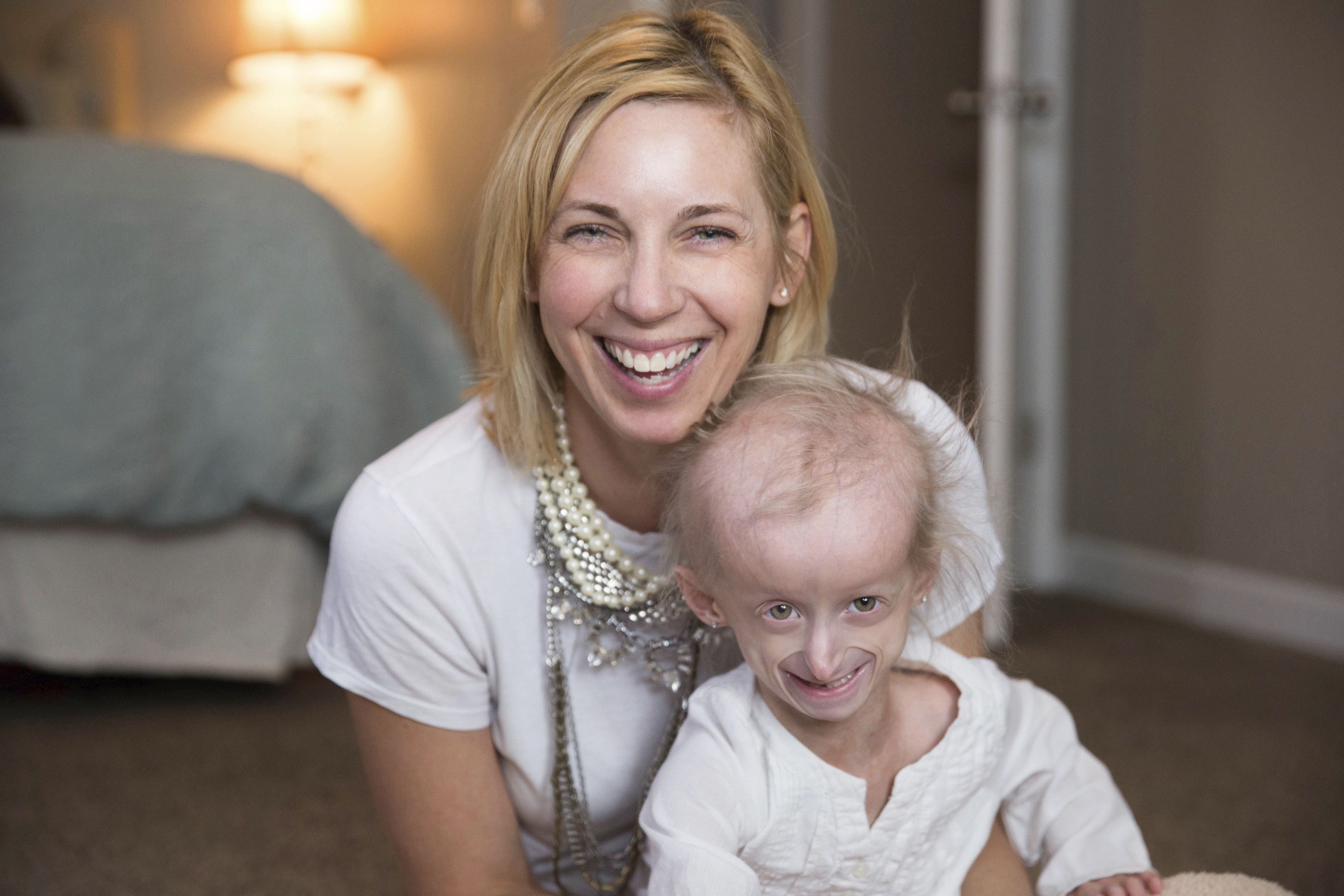 Kids with rare rapid-aging disease get hope from study drug