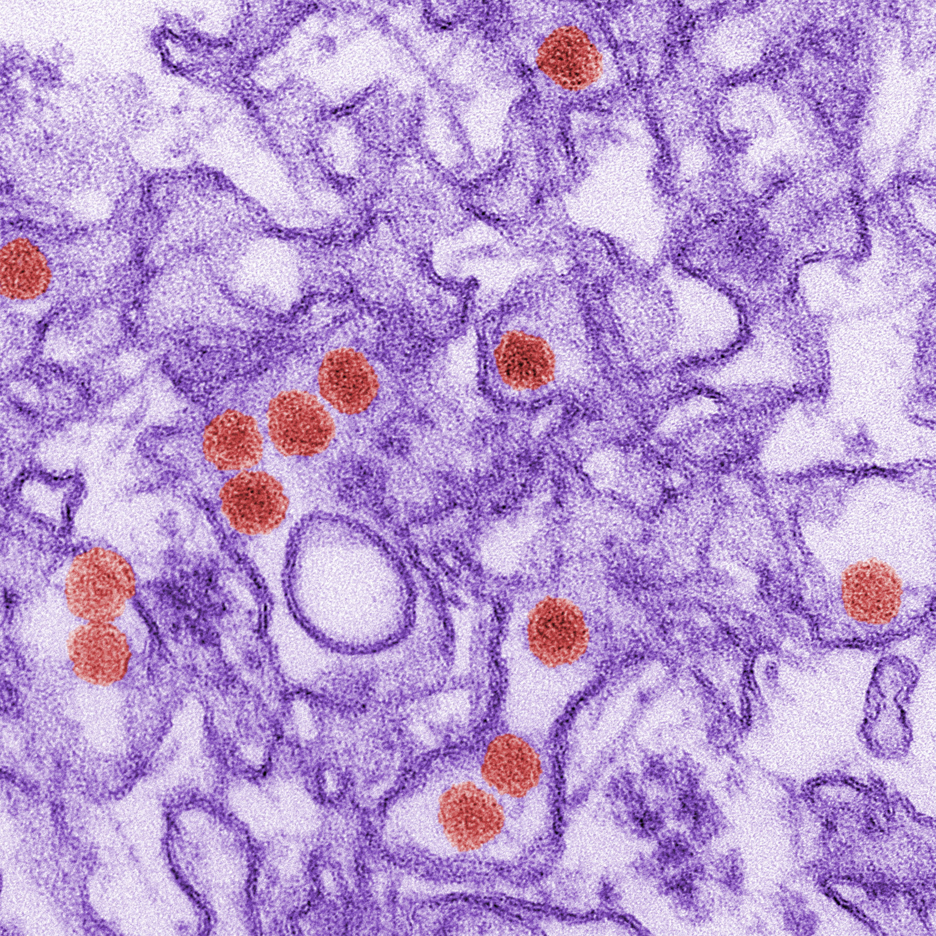 Study finds little bang for the buck in Zika blood testing