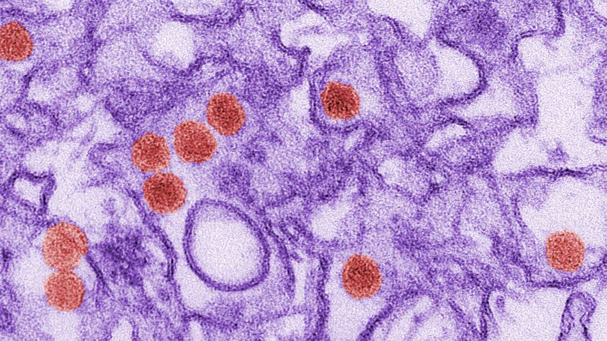 Study finds little bang for the buck in Zika blood testing