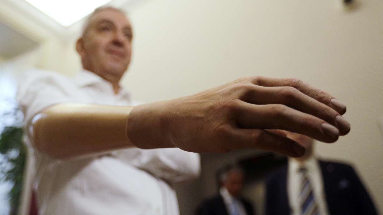 Italian researchers develop lighter, cheaper robotic hand
