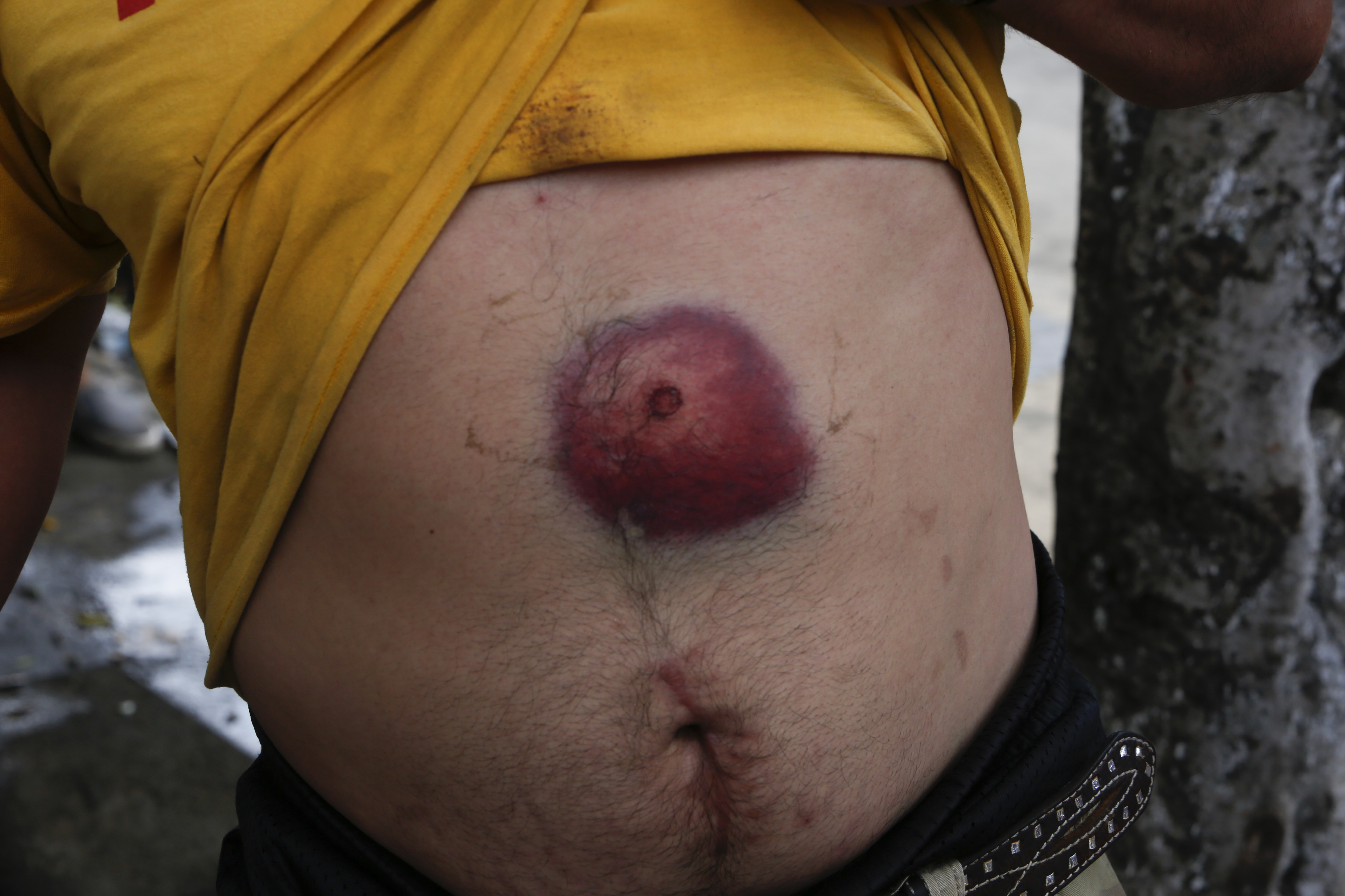 Violence at protests in Nicaragua leaves 2 more dead