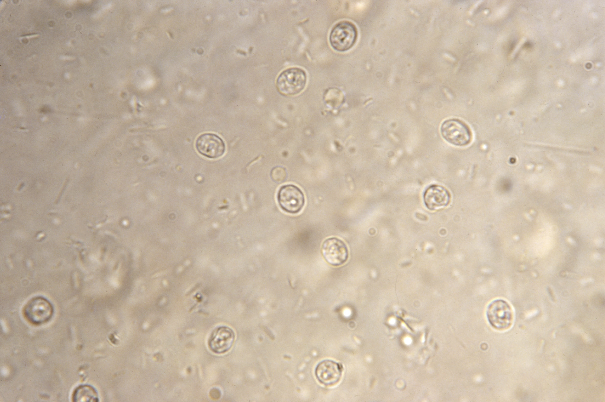 Health officials: Stay out of the pool if you have diarrhea