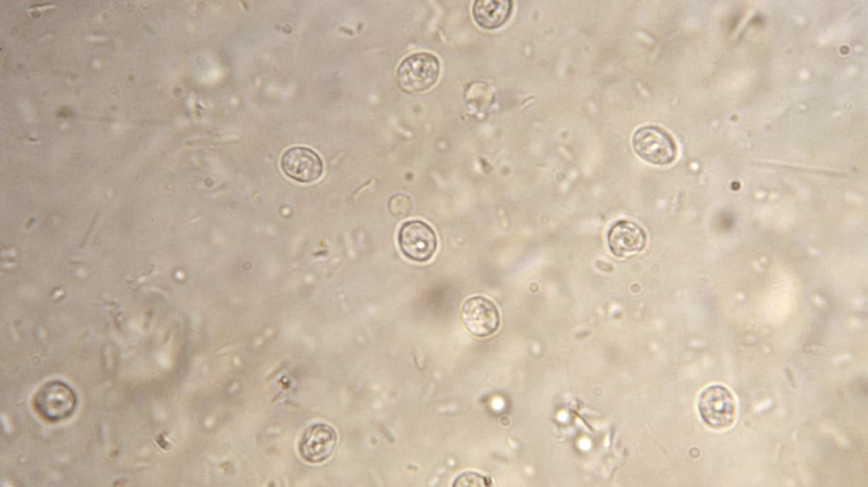 Health officials: Stay out of the pool if you have diarrhea