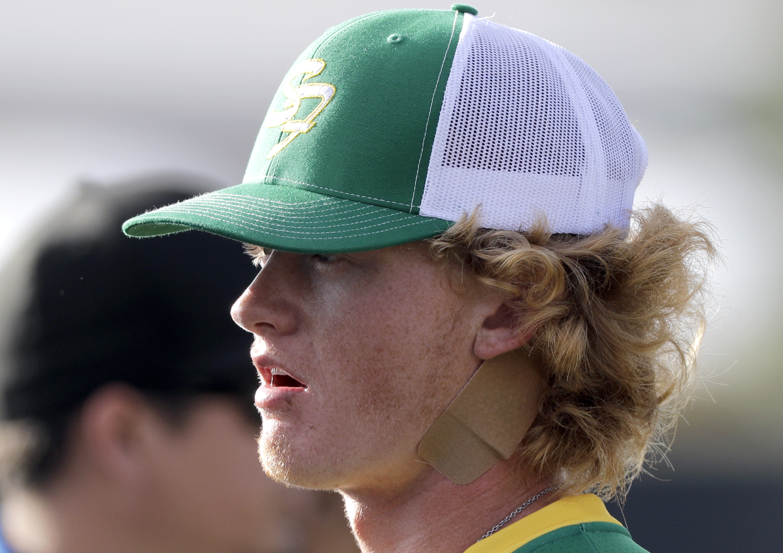 Santa Fe High School baseball player Rome Shubert wears a bandage on his neck before a baseball game against Kingwood Park High School in Deer Park, Texas, Saturday, May 19, 2018. A gunman opened fire inside Santa Fe High School Friday, May 18, 2018, killing at least 10 people. Shubert was hit in the neck during the shooting. (AP Photo/David J. Phillip)