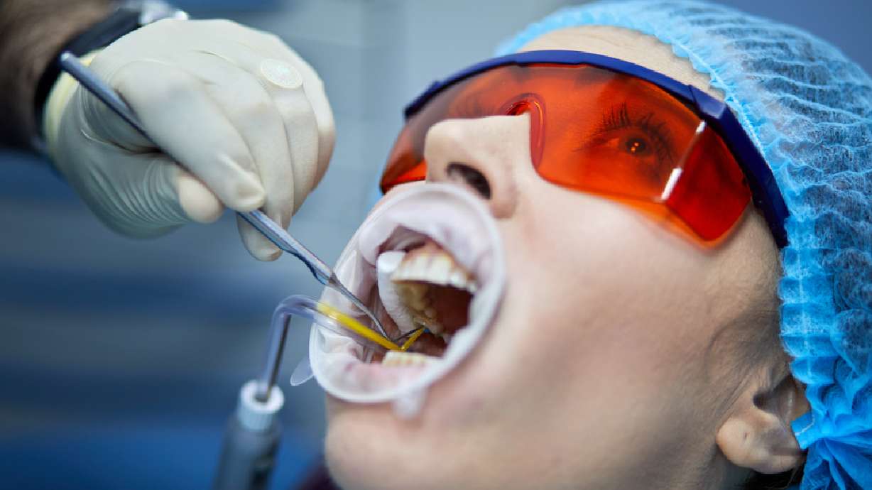 Implants versus dentures or bridges: 6 facts everyone should understand