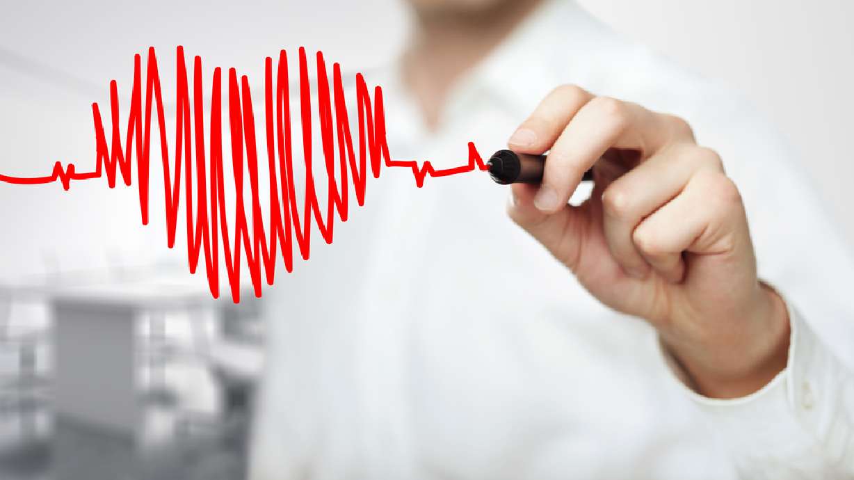 Critical warning signs of atrial fibrillation and stroke