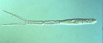 Photo of cercarial dermititis, parasite that causes swimmer’s itch. (Photo: Center for Disease Control)