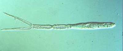 Photo of cercarial dermititis, parasite that causes swimmer’s itch. (Photo: Center for Disease Control)