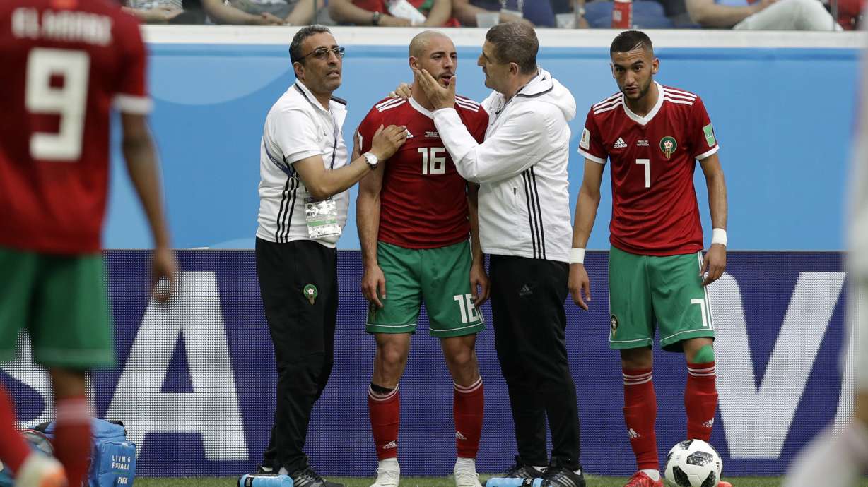 Player union blasts concussion management at World Cup