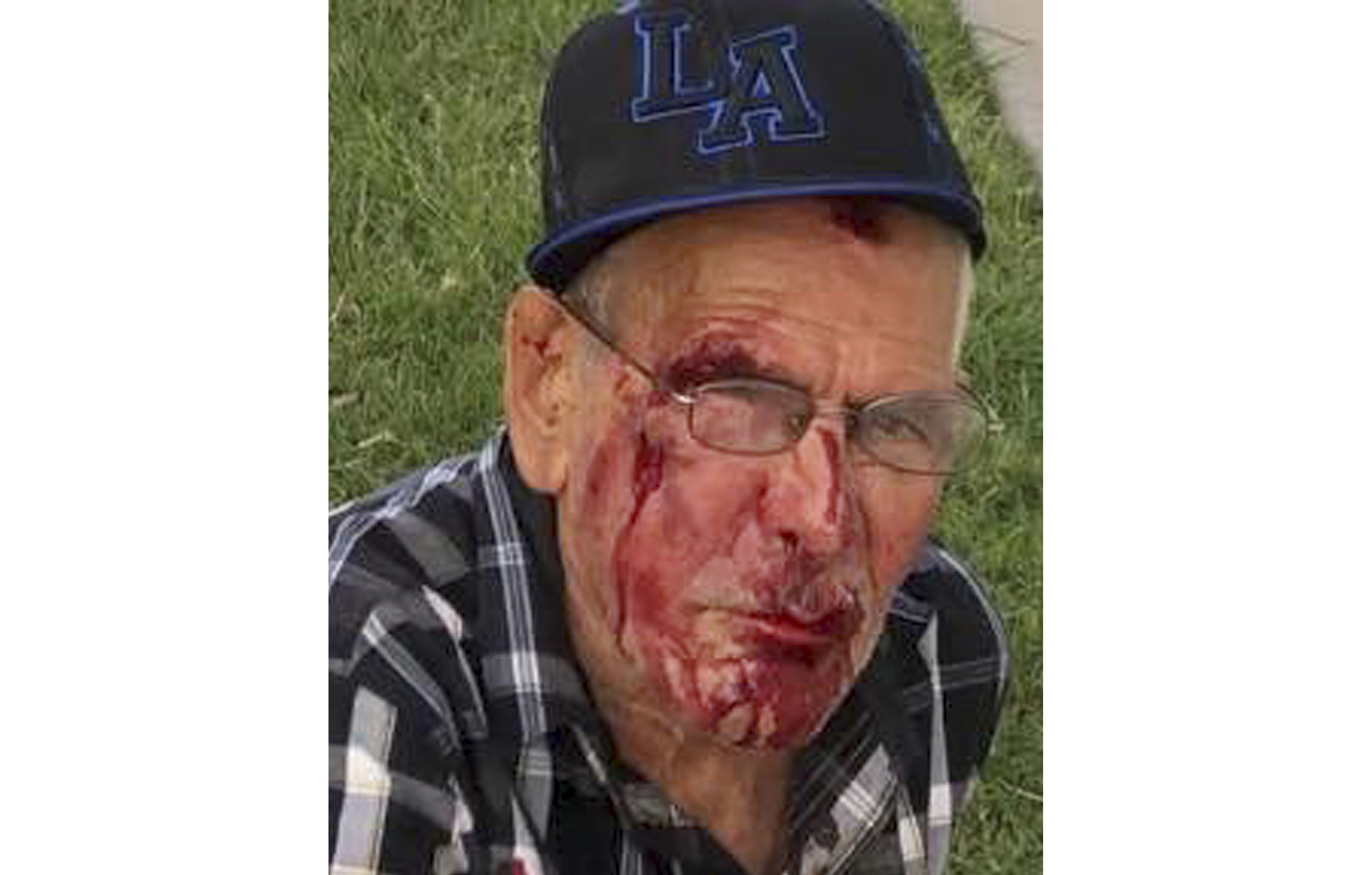 The Latest: Elderly man beaten bloody thanks key witness