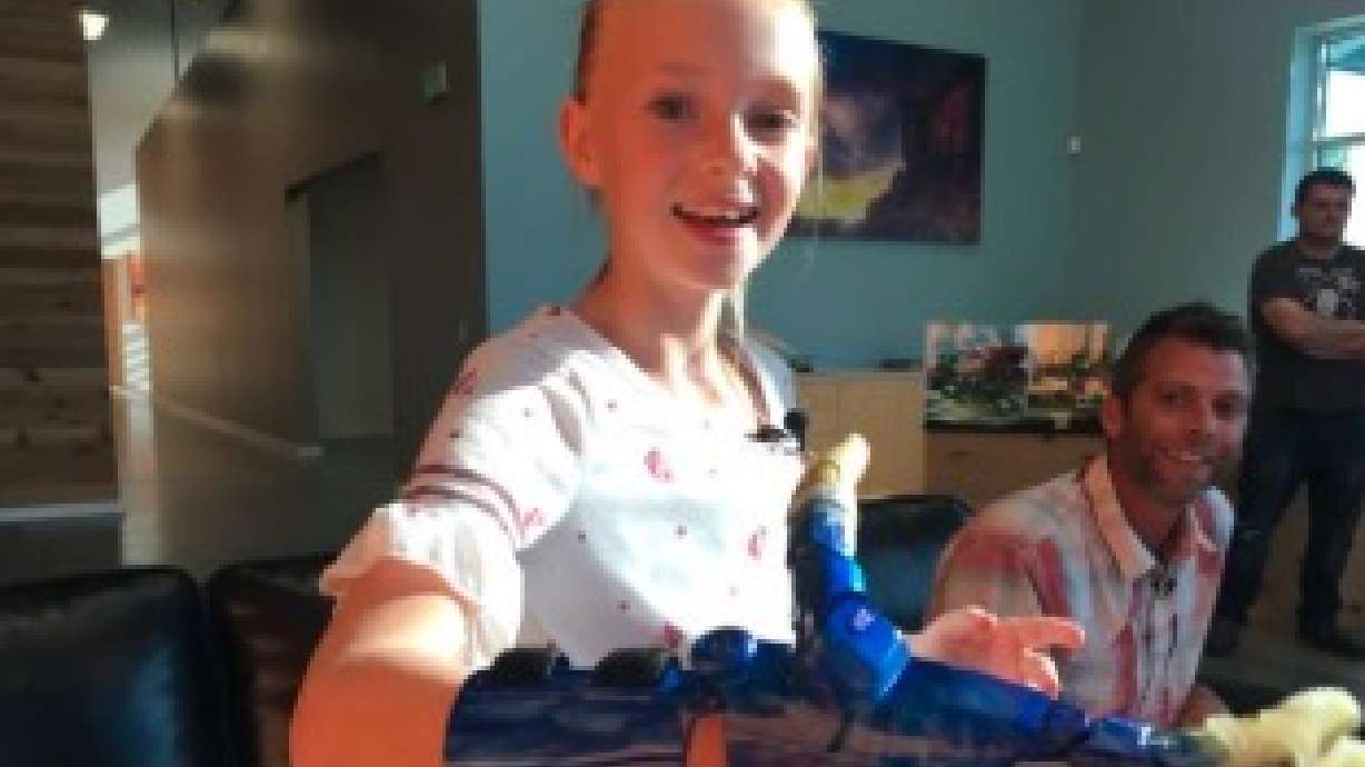 Clearfield girl gets new hand, new grasp on life