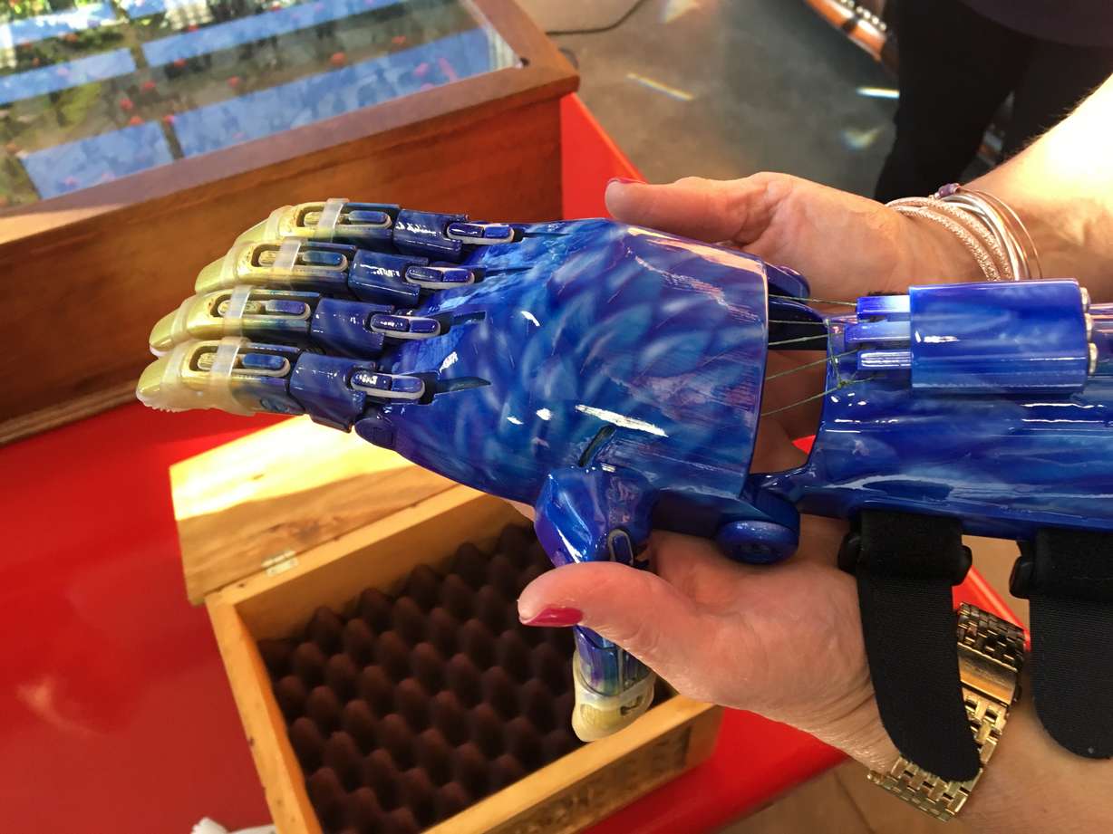Andi Cottle's prosthetic hand is pictured. (Photo: KSL Newsradio)