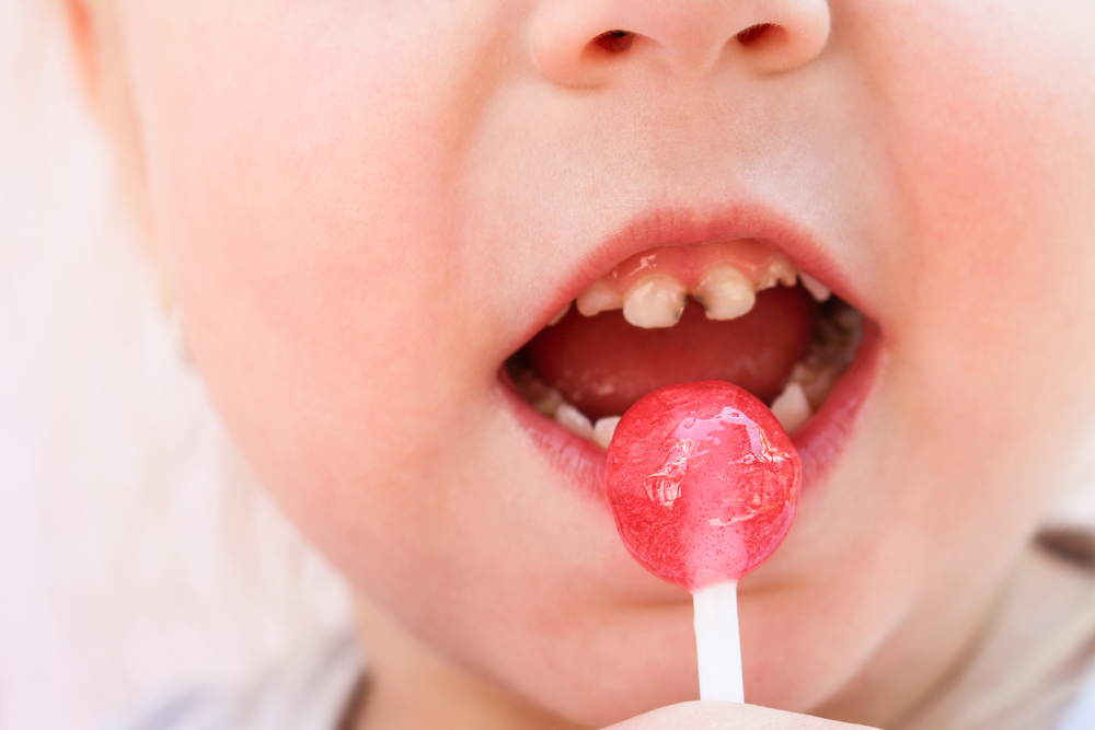 7 common and surprising things that can ruin your teeth