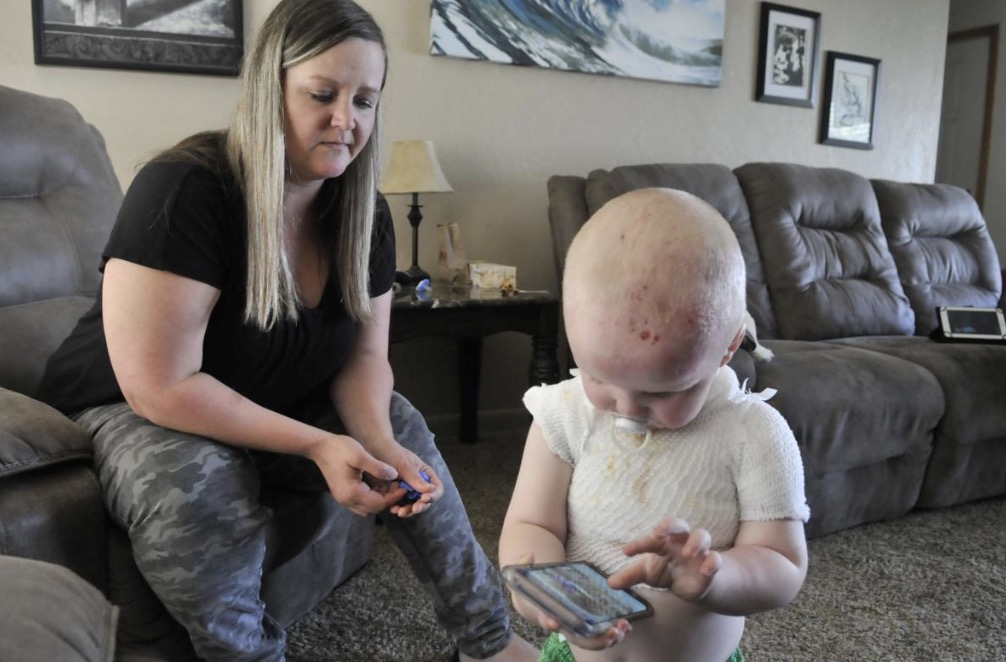 Toddler recovering after pressure cooker 'geyser' covers him with boiling food