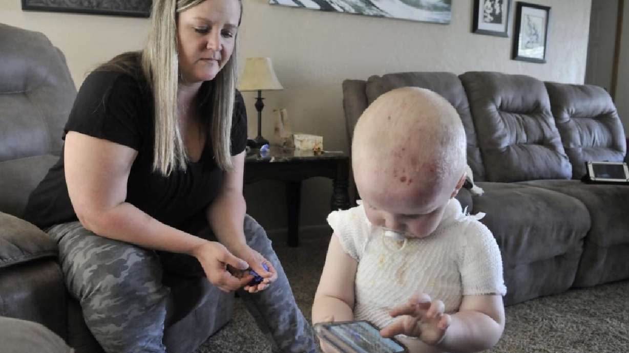 Toddler recovering after pressure cooker 'geyser' covers him with boiling food