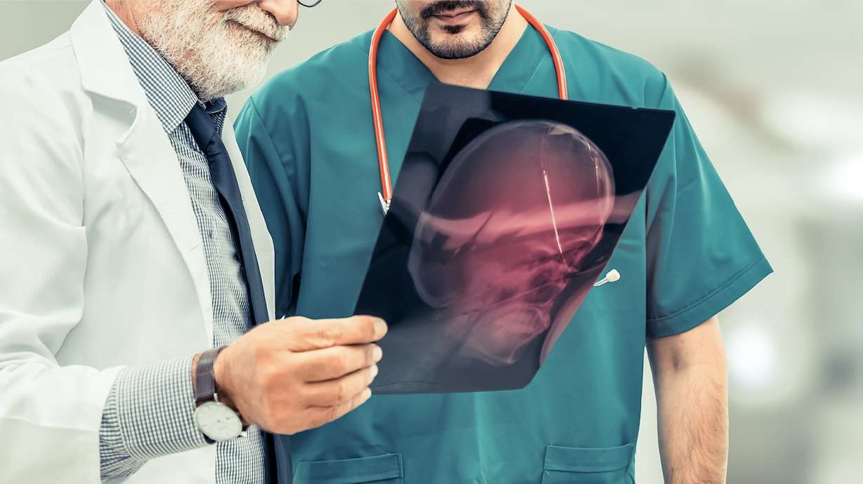 Appendix removal is linked to lower risk of Parkinson's