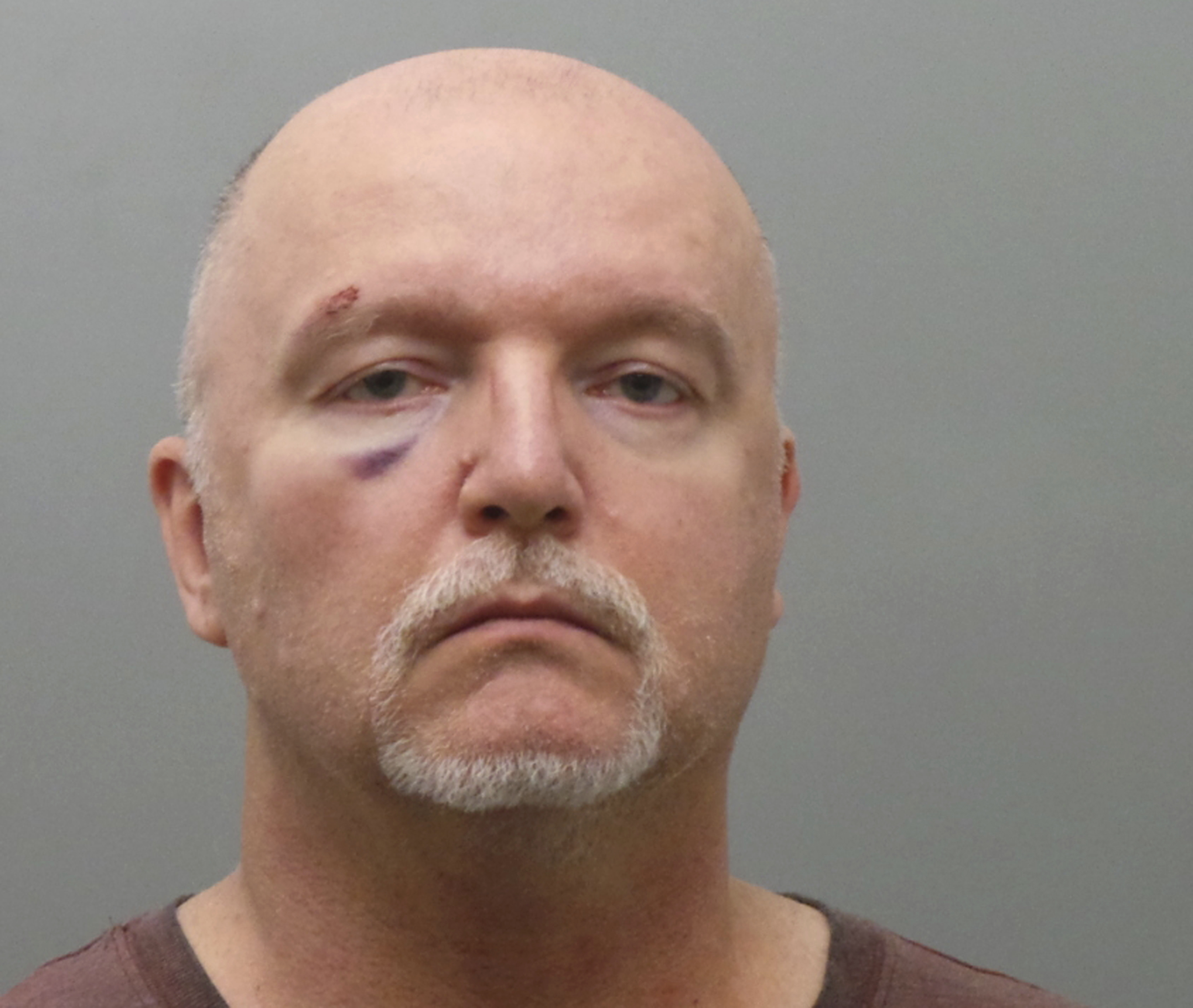 Catholic Supply attack suspect makes first court appearance