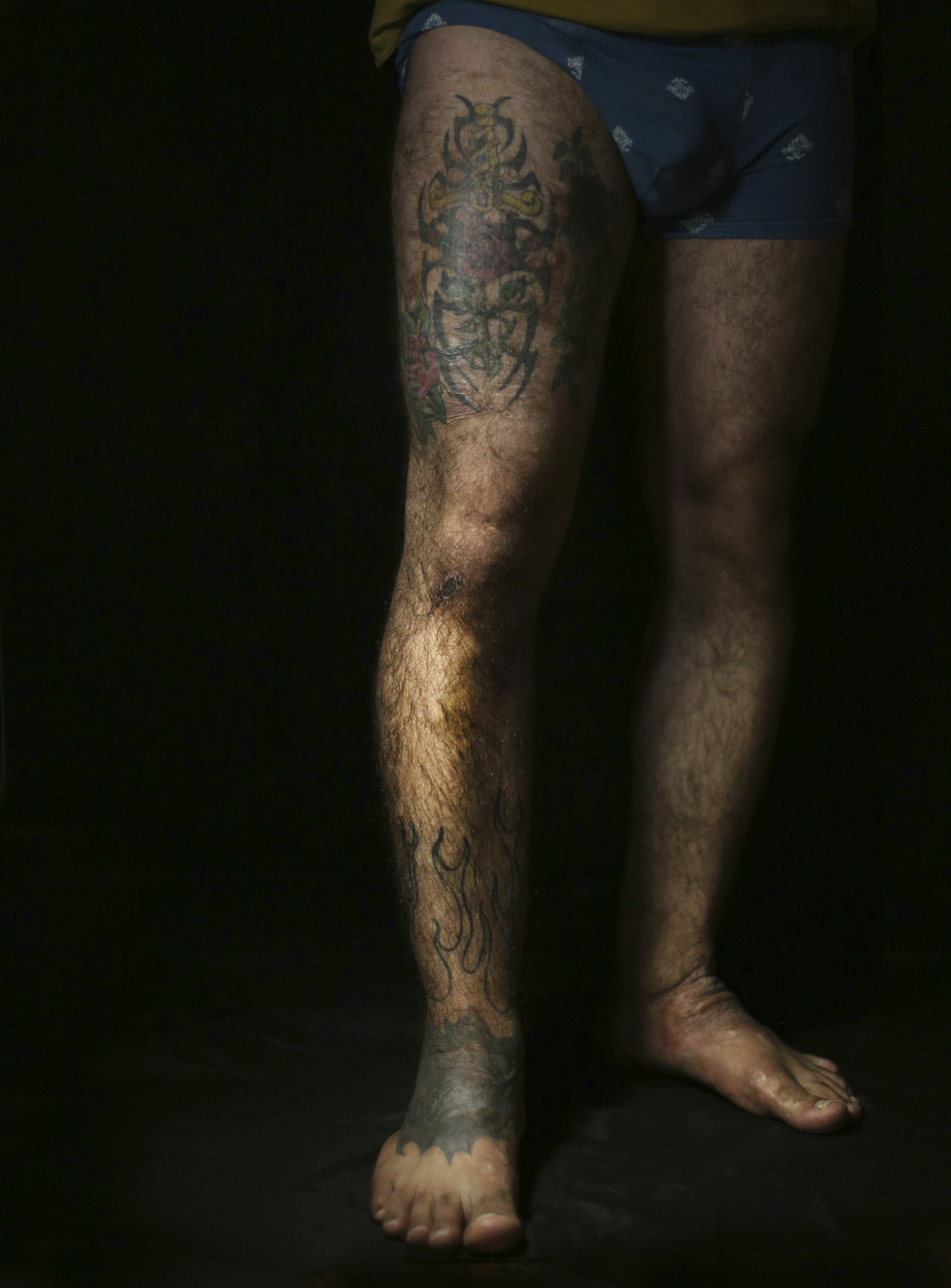AP PHOTOS: Iraqis seek tattoos to cover scars of war