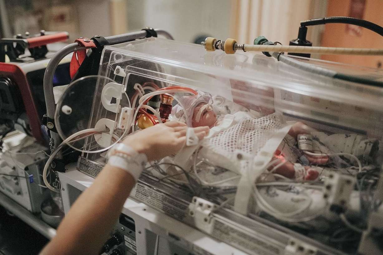 Evelyn was born several weeks early, only weighing three pounds and one ounce. (Photo: Katelyn and Zac)