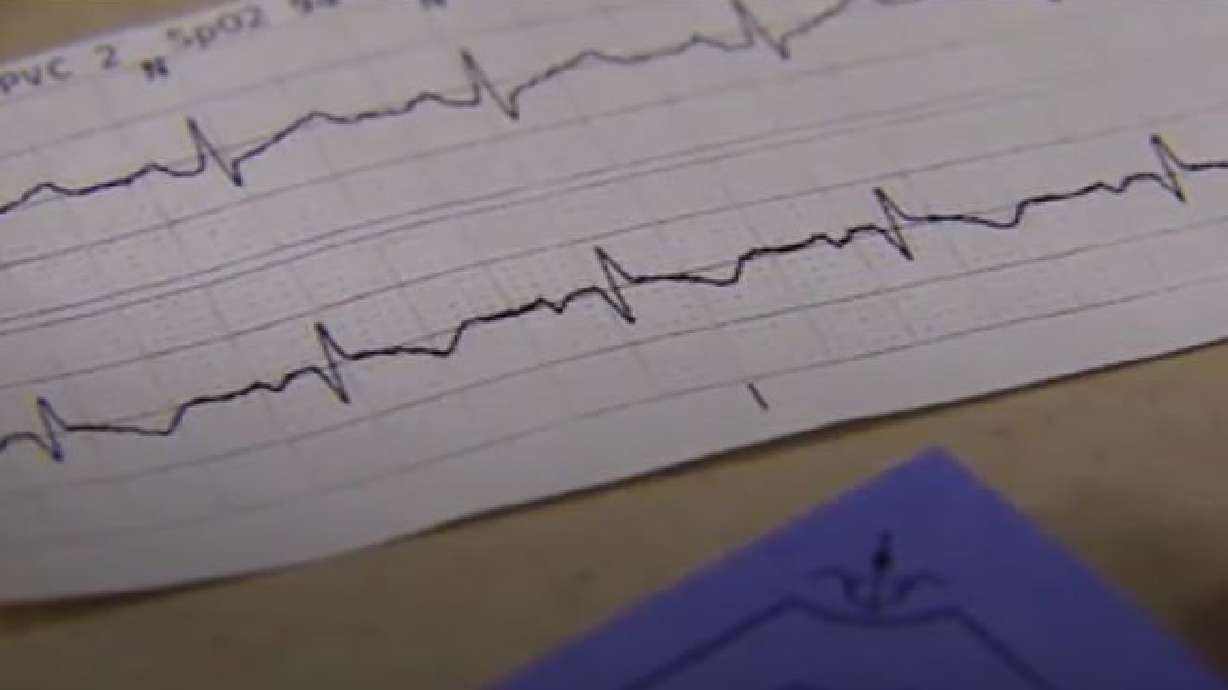 Nurse remembers deceased patients with EKG print