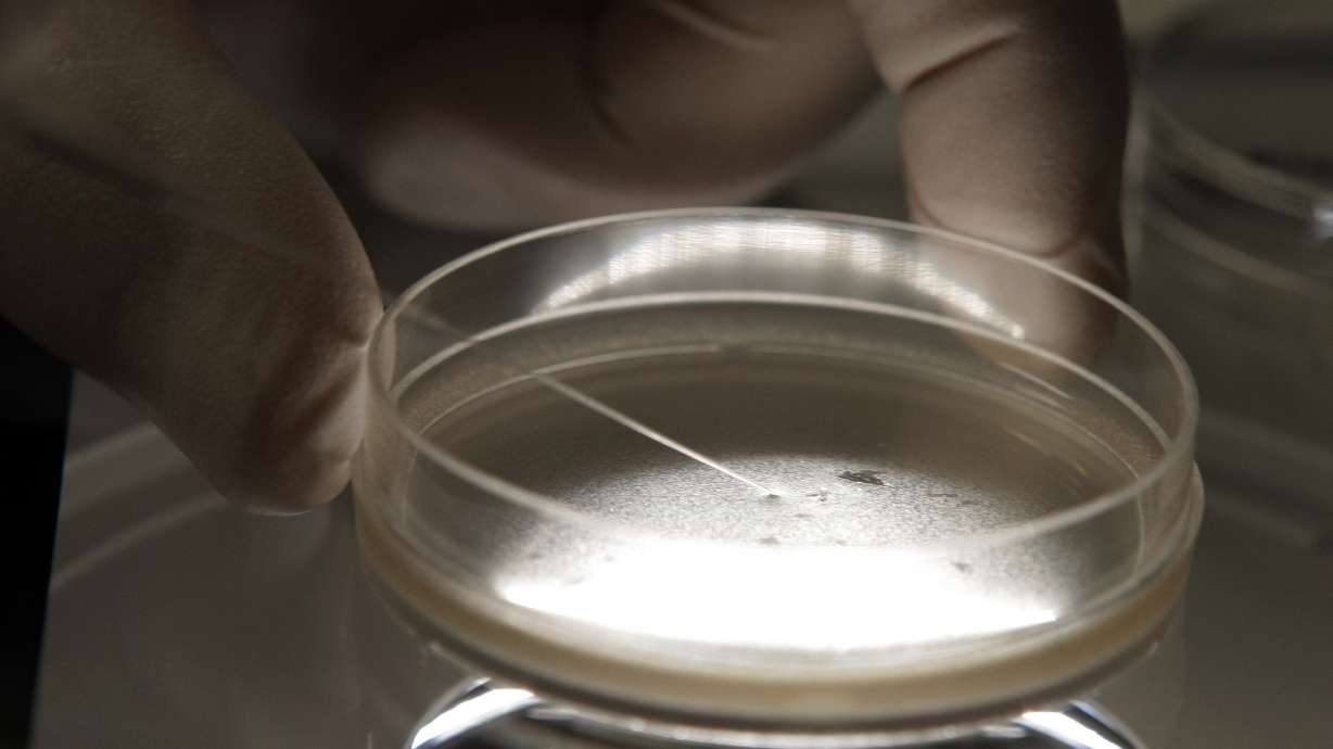 Stem cell shots linked to bacterial infection outbreak