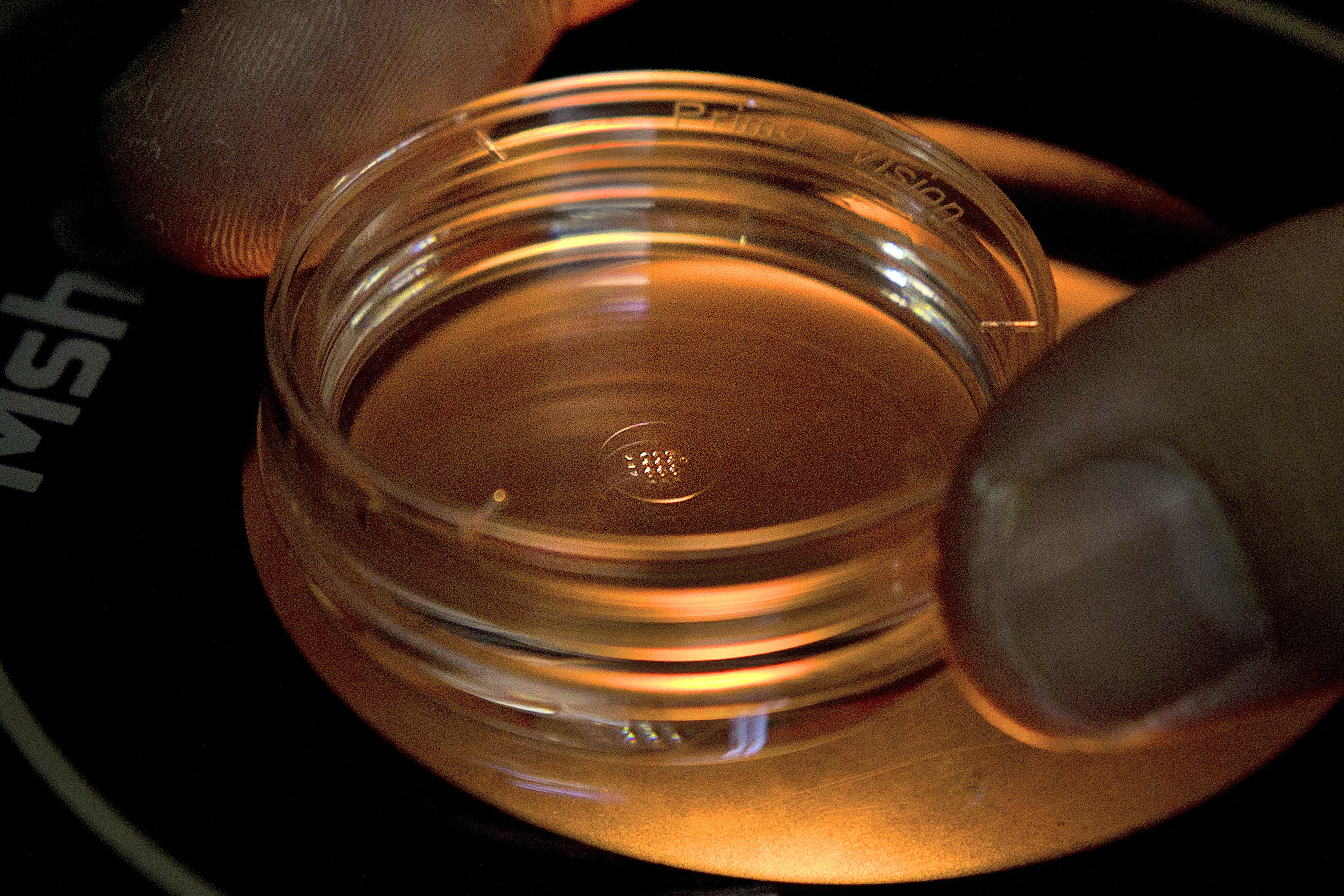 AP-NORC Poll: Most support gene editing to protect babies