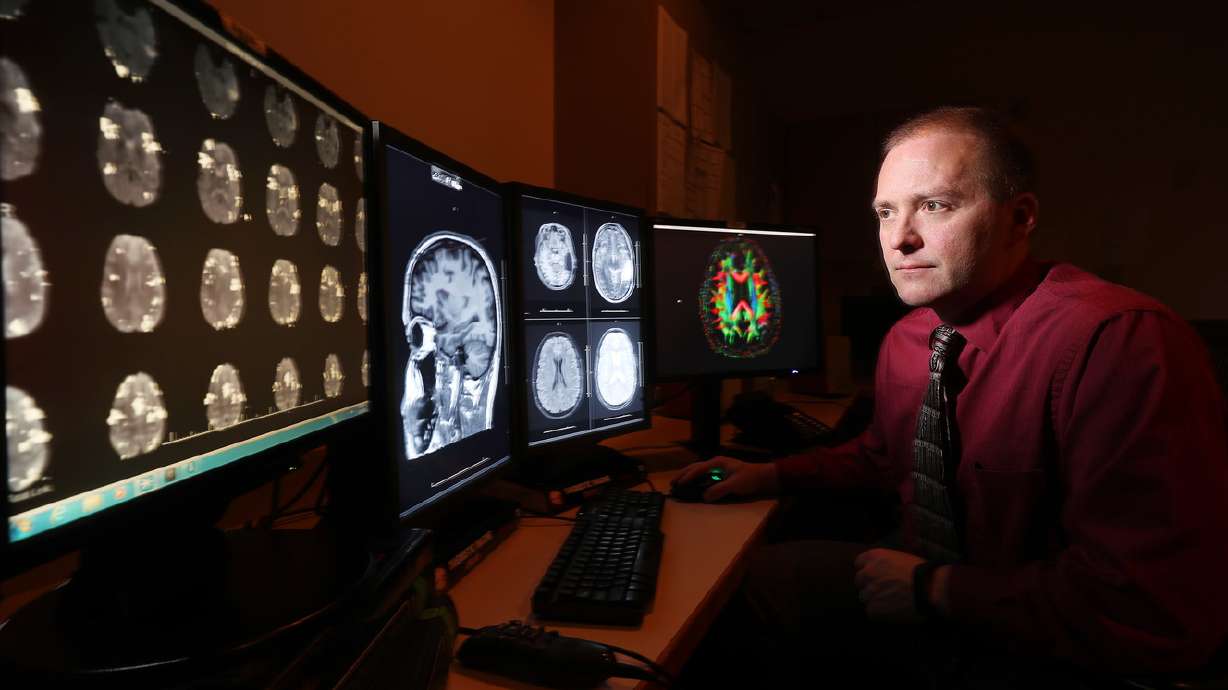 U. researchers: Alzheimer's patients can benefit from familiar music