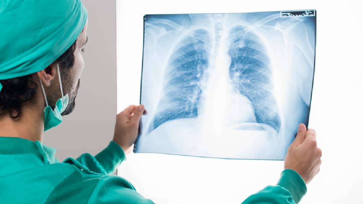 In case you didn't know, 8 ways Utah's winter inversions are killing you