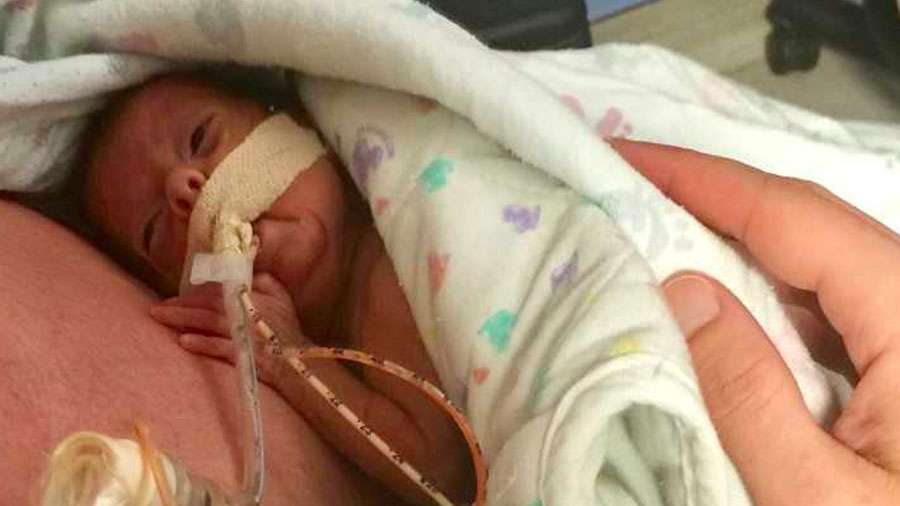 Zariah Donovan was born at 23 weeks and 6 days. She was given a slim chance of survival and had open-heart surgery at just 3 weeks old. After 10 weeks on a ventilator, her doctors said her chances of survival dropped to zero. But they were wrong. (Photo: Family photo)