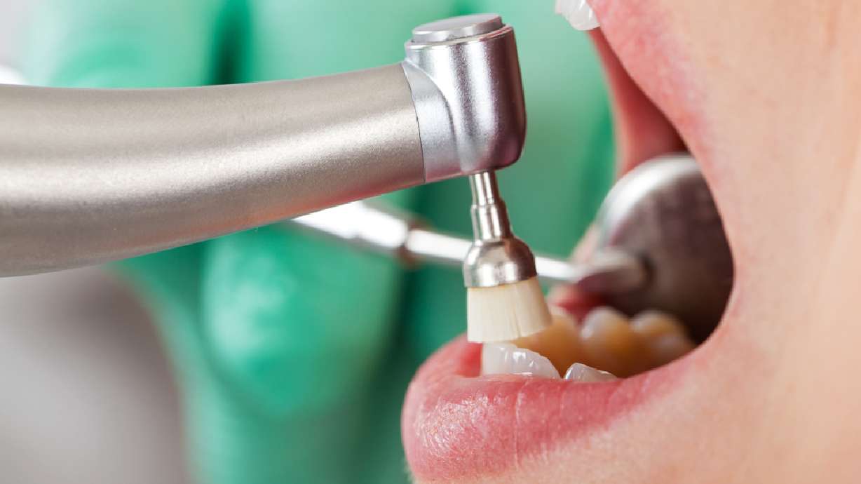 8 reasons regular dental cleanings are truly important