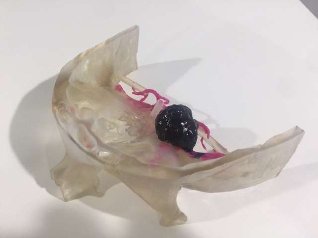 Courtesy of Intermountain Healthcare