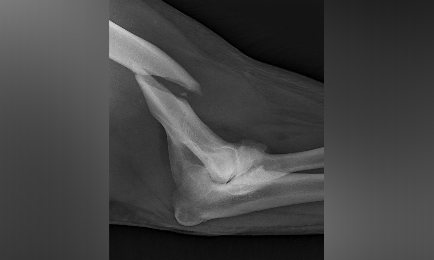 An X-ray photo of Nora's humerus taken on Sunday, Jan. 27, 2019, that shows the break in the bone. Hogle Zoo officials believe the break happened on Jan. 23. (Photo: Hogle Zoo)