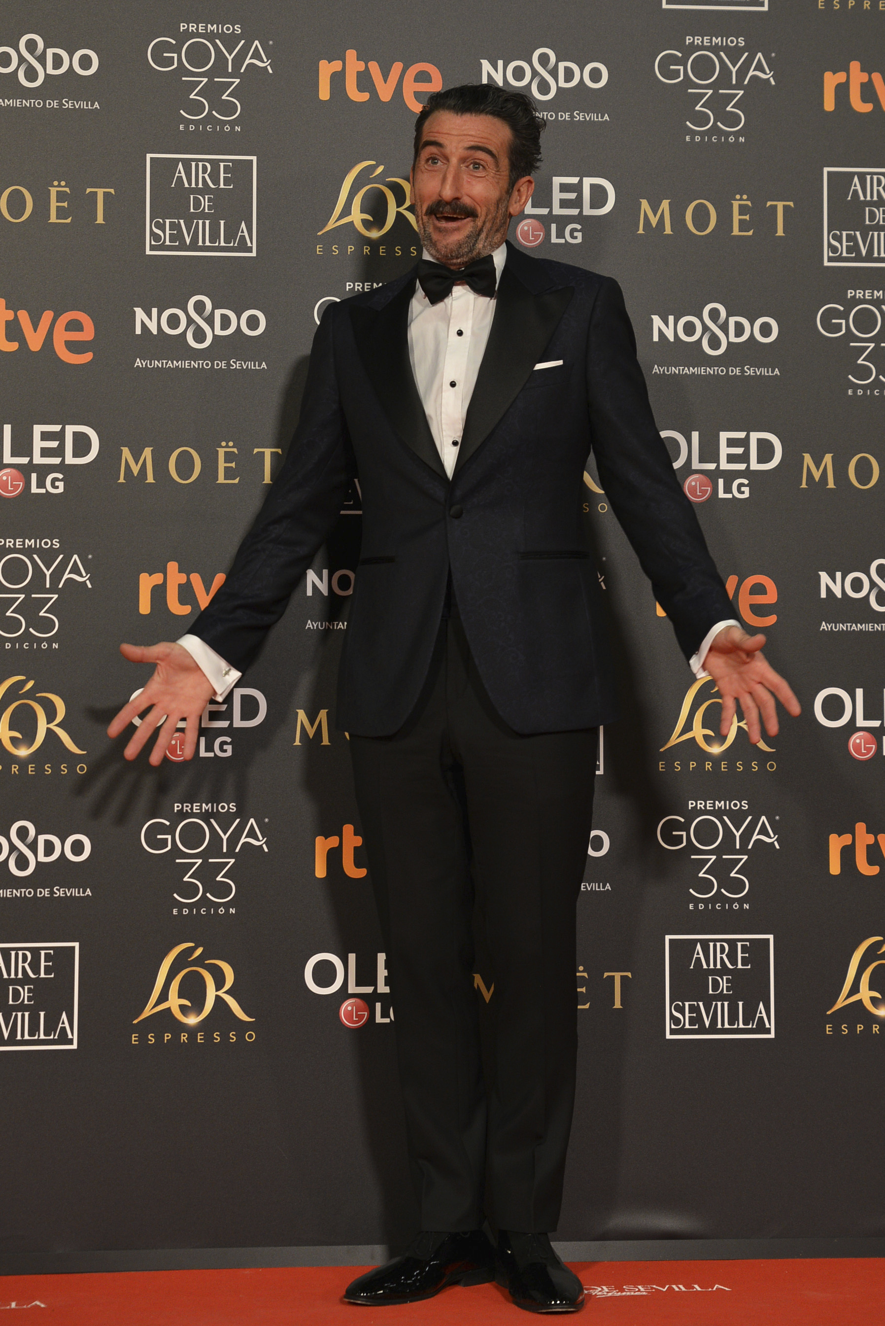 Film featuring disabled actors wins Spain's top Goya award
