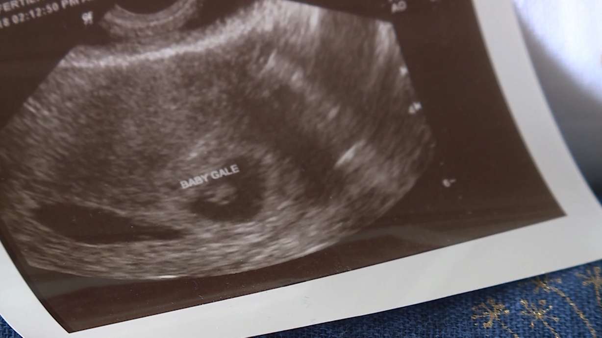 An ultrasound image shows one of the first pictures of Jessica Gale's first child. The Payson mother-to-be worked two jobs and panhandled in her spare time to earn enough money to pay for in vitro fertilization. (Photo: Ray Boone, KSL TV)